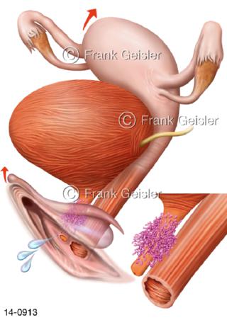 Genitalien Frau, Erregung Skene-Drüsen Paraurethraldrüsen