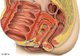 Genitalien Frau, G-Punkt G-Zone Gräfenberg-Zone in Vaginalwand
