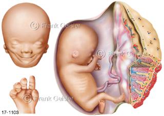 Embryologie, Entwicklung 70 Tage Fetus Fötus mit Plazenta