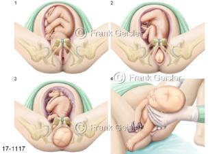 Geburtsphasen, Eröffnungsperiode Latenzphase Austreibungsperiode Austreibungsphase