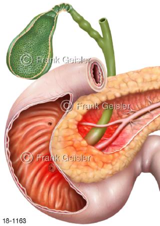 Pankreatitis Pankreas, Pankreasinsuffizienz