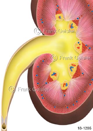 Harnleiter Urinstau Harnverhalt in Nierenkelch