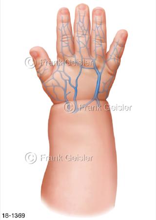 Notfall, Venen Baby Kinderhand Kleinkind