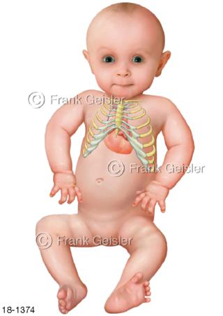 Notfall Lage Brustkorb Herz Baby
