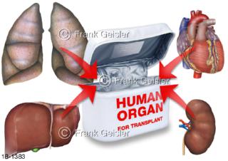 Notfallmedizin, TransportTransplatation Organe durch Human-Organs-Transplant