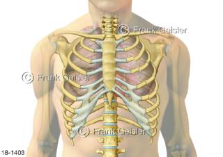Notfall, doppelter Rippenserienbruch Rippenserienfraktur Serienbruch der Rippen