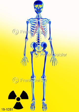 Medical-Art Radioaktivität Skelett Knochen Mensch