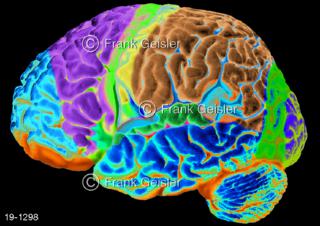 Medical-Art Gehirn mit Hirnareale, räumlich abgrenzbare Bereiche im Großhirn 