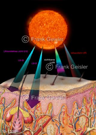 Medical-Art Strahlung Sonne Sonnenlicht Haut