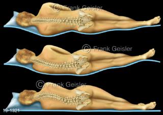 Medical-Art Schlaf, richtige Lagerungen Wirbelsäule