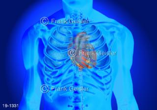 Medical-Art Brustkorb, Lage Organe Thorax mit Herz 