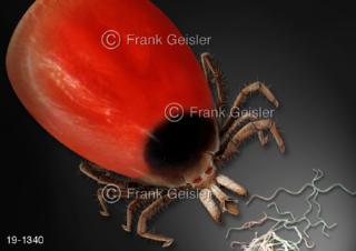 Medical-Art Zecke, Borrelien Erreger FMSE-Infektion