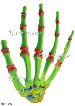 Medical-Art Handwurzel Knochen Hand
