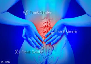 Medical-Art Rücken Schmerzen Rückenschmerzen Lendenwirbelsäule