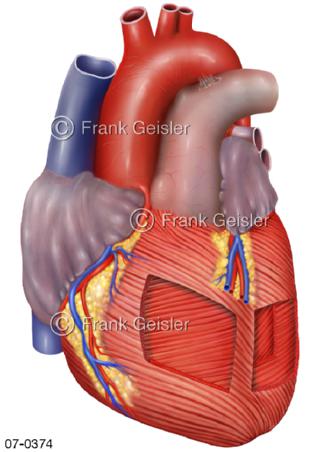 Herz, Myokard Herzmuskel Herzmuskulatur