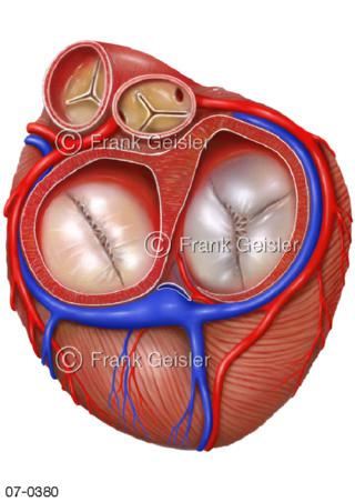Herz Oberfläche, Ventilebene mit Herzklappen