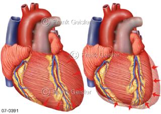 Herzschlag Herz, Herzzyklus Kontraktion Systole und Diastole