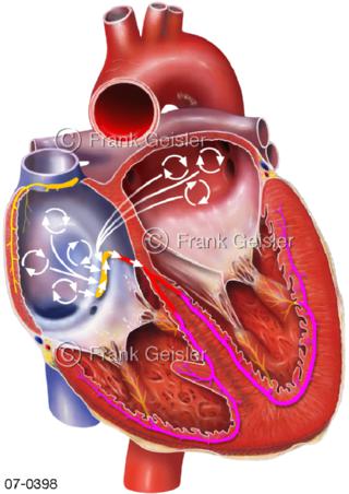 Herz Vorhofflimmern, Erregungsleitung Atrium Ventrikel