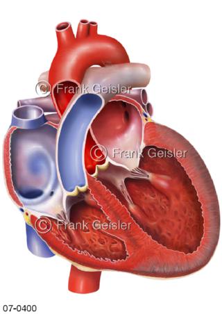Herzkammern Herzventrikel Herzinsuffizienz Herzschwäche