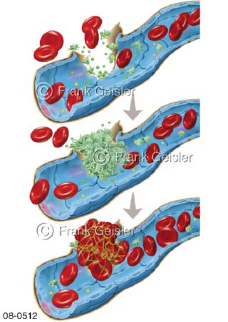 primäre sekundäre Hämostase, Blutgerinnung