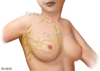 Brüste der Frau mit Lymphgefäße Lymphknoten