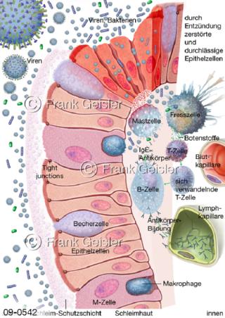 Immunreaktion der Schleimhaut, lymphatisches Gewebe