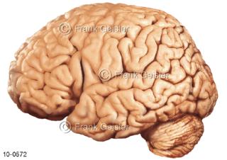 Großhirn mit Kleinhirn von lateral