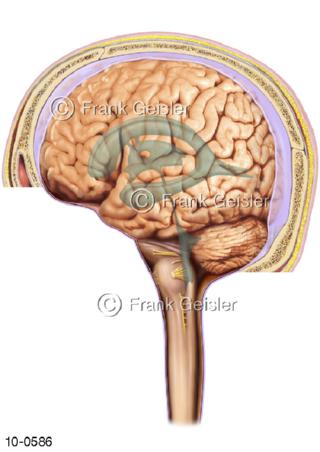 Seitenansicht Gehirn mit Hirnventrikel