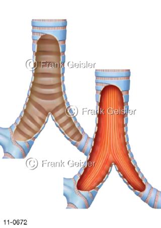 Luftröhre Trachea Bronchus Knorpelspangen Schleimhaut