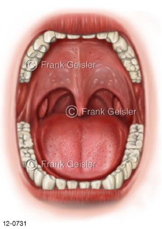 Mund mit Zunge, Rachenmandeln Polypen Rachen