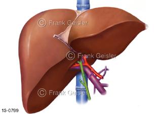 Transplantation Leber Hepar, Lebertransplantation Leber-OP
