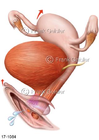 Erregung Geschlechtsorgane der Frau