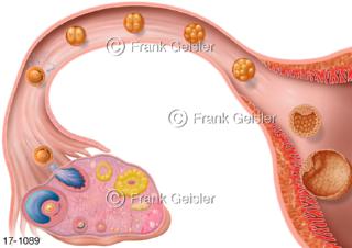 Eierstock Eisprung Ovulation, Befruchtung Eizelle in Eileiter, Einnistung Blastozyte in Gebärmutter