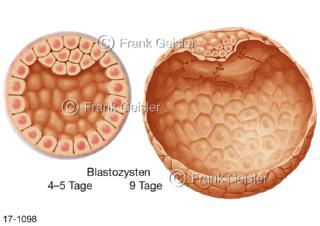 Fortpflanzung, befruchtete Eizellen Zygoten, Zellstadien Blastozysten