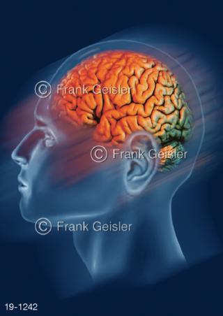 Kopf Gehirn Neuroaktivitäten ZNS