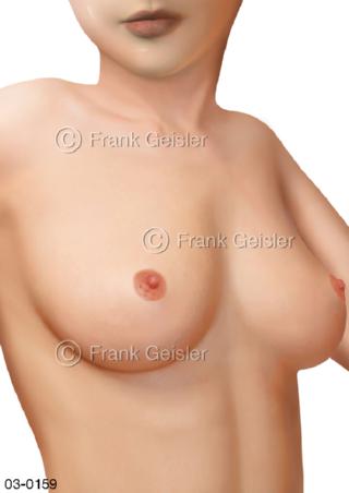 Brust, Mamma Brustdrüse der Frau