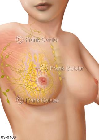 Brust, Brustdrüse Brustgewebe mit Lymphknoten