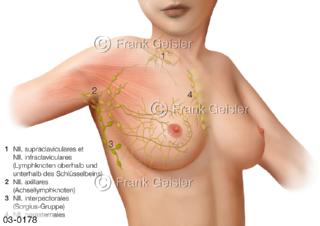 Brust, Lymphgefäße mit Lymphknoten der Brustdrüse