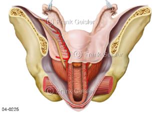 Organe der Frau, weibliche Beckenorgane mit Peritoneum von dorsal