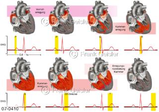 Herz Herzerregung Erregungsletungssystem mit EKG-Kurven