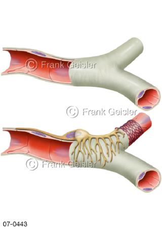 Aufbau Gefäße Blutgefäße Blutkapillare