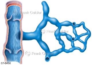 Venen mit Varizen, Krampfadern bei Varikose