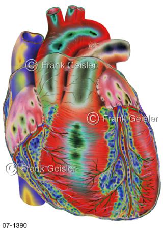 Herz Ventriculus Cor mit Koronargefäße