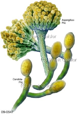 Aspergillus Schimmelpilz, Candida Hefepilz