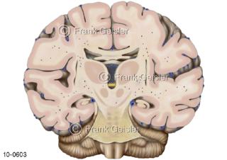 ZNS Gehirn, Frontalschnitt durch Teile Zwischenhirn Mittelhirn