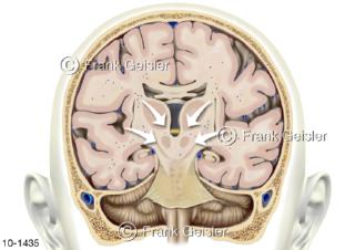 Schädel-Hirn-Hirndruck, intrakranieller Druck im Schädelinneren im Gehirn