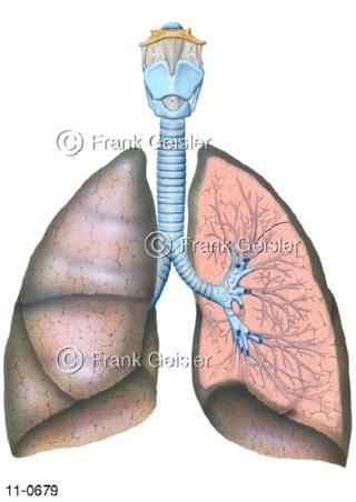 Atemtrakt Kehlkopf Luftröhre Trachea Lunge mit Bronchien, linke Lunge eröffnet