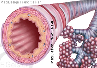 Lumen eines Bronchus mit Bronchioli und Alveolen