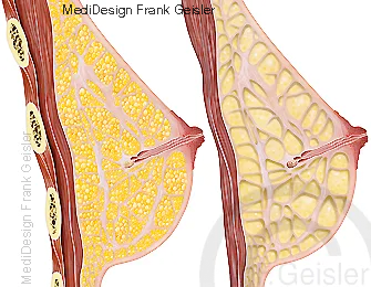 Schnitt durch Brustdrüse, Darstellungen Gewebe der Mamma