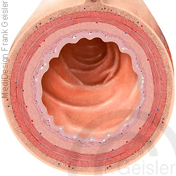 Lumen Dünndarm Ileum